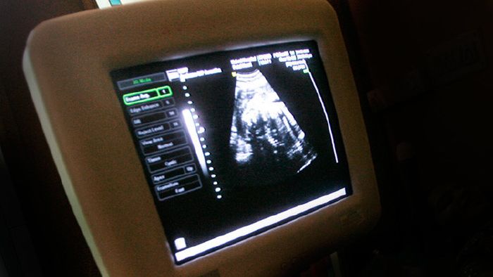 Feminista: "Decidí abortar cuando supe que mi bebé sería niño"
