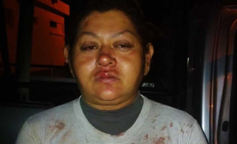 Sabinas: Mujer le saca las tripas a su esposo.