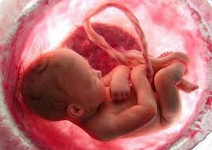 En México, el primer equipo que realiza cirugía fetal en el continente
