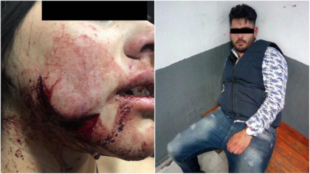 Violencia feminicida: Acuchilla en la cara a su novia en calles de la Roma