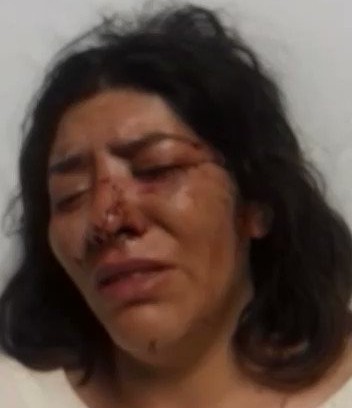 Acusan que regidor de Tlaxcala mandó golpear a su ex empleada