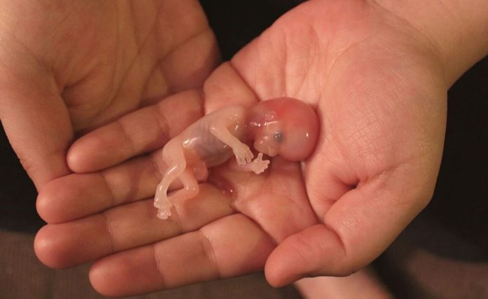 Por la autodeterminación de las mujeres, presentará Morena despenalización del aborto