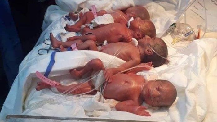 Una mujer da a luz a septillizos de forma natural en una caso "raro y único" en Irak