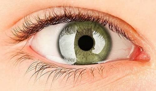 Síndrome del ojo seco.