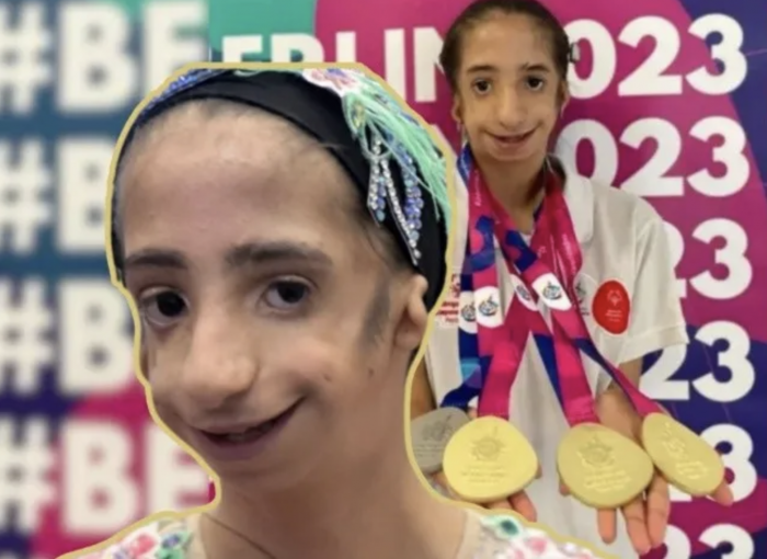 Mexicana Valery Vera gana 3 medallas de Oro en Berlín siendo la gimnasta más joven de la competencia