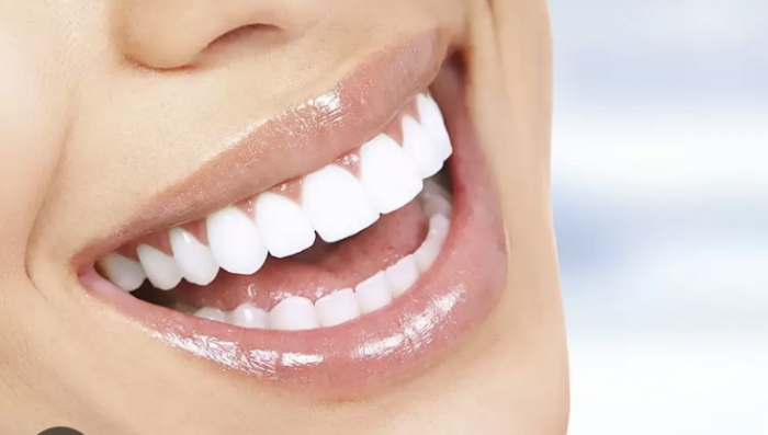 Blanqueamiento dental: ¿Es seguro usar bicarbonato de sodio?
